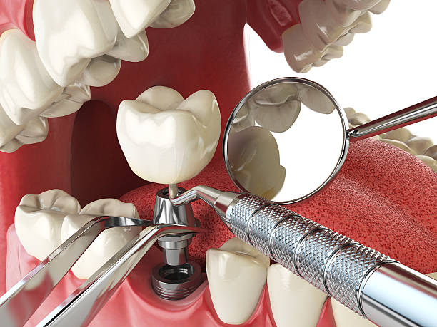 Best Emergency Root Canal Treatment in Broadway, NC